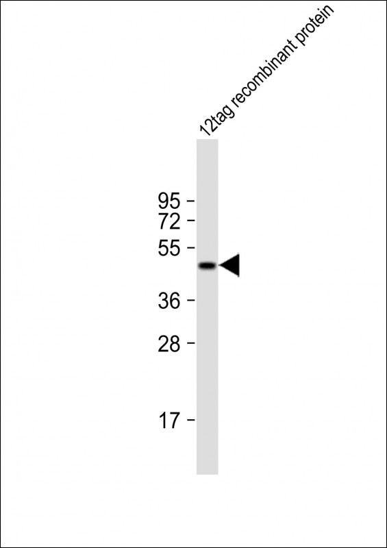 WB - HIS Tag Antibody, HRP Conjugate AM8499b