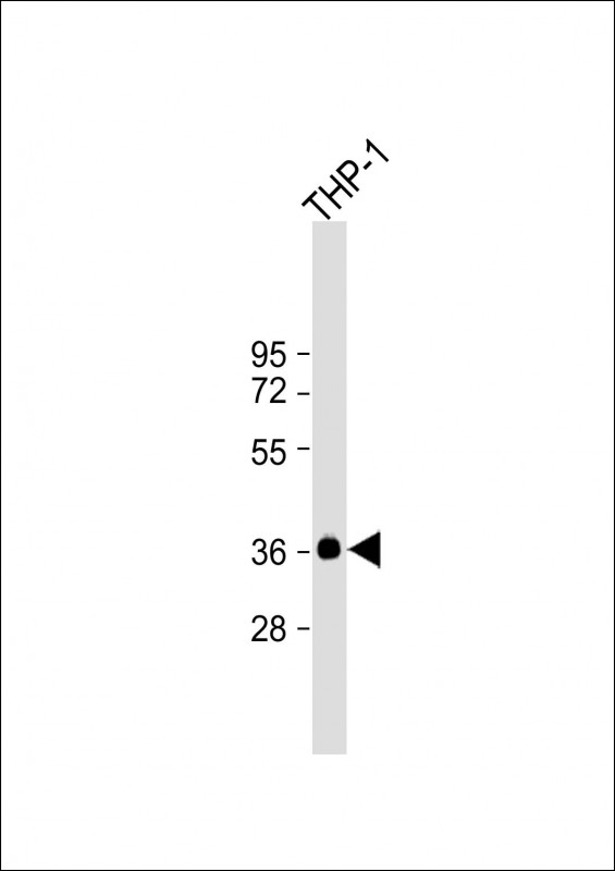 WB - IKB alpha (IKBA) Antibody AP2506a