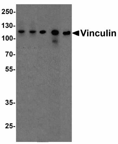 WB - Vinculin Antibody ASC12055