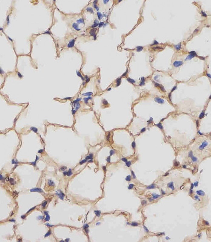 IHC-P - Mouse Csf1r Antibody (C-term) AP13911b