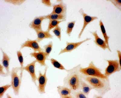 ICC - Anti-Aquaporin 3 Antibody ABO10807