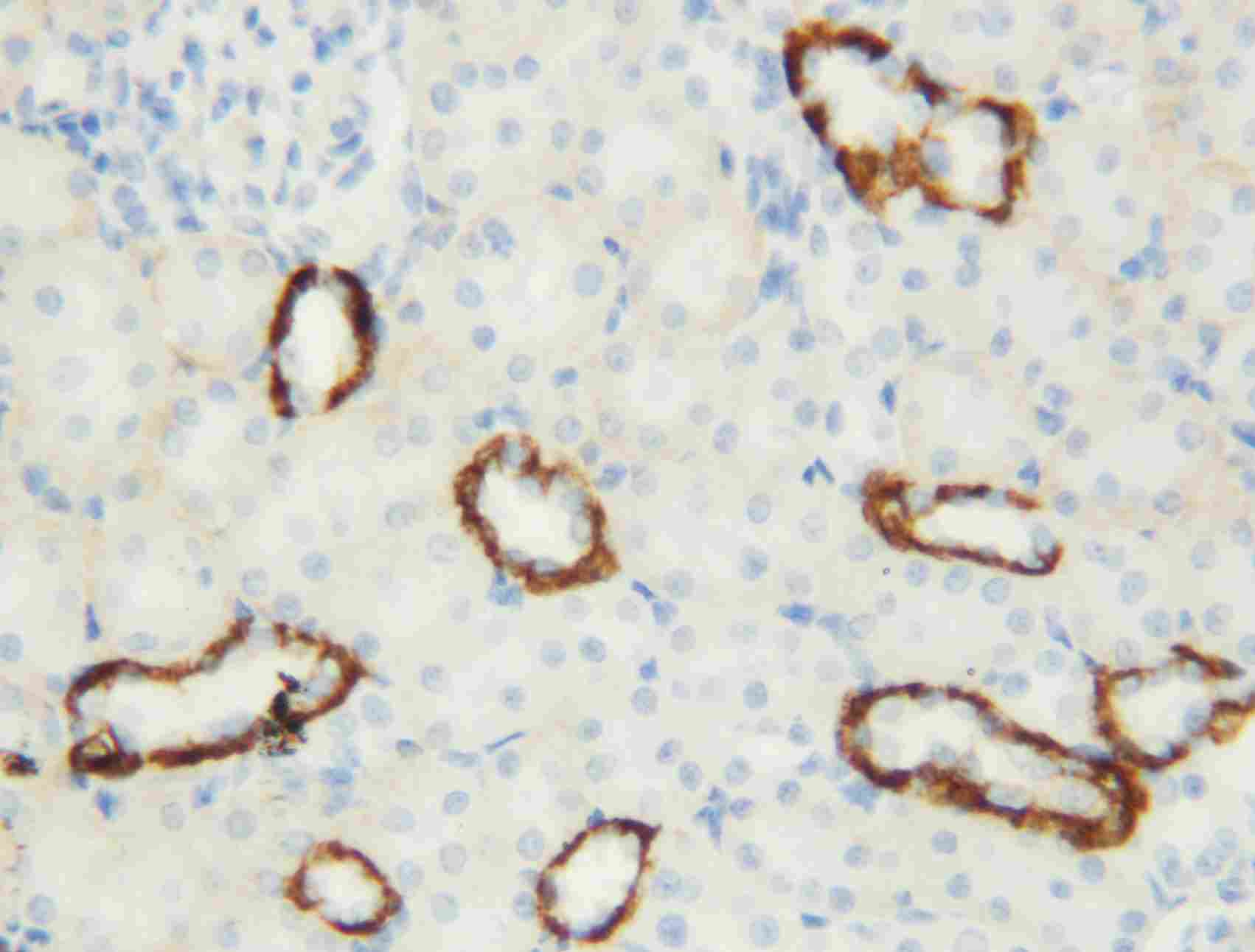 IHC - Anti-Aquaporin 3 Antibody ABO10807