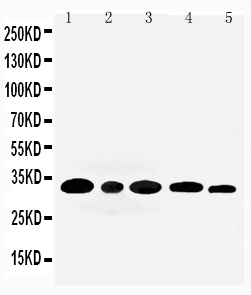 WB - Anti-Aquaporin 3 Antibody ABO10807