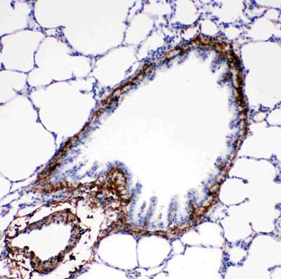 IHC - Anti-Collagen I Antibody ABO11450