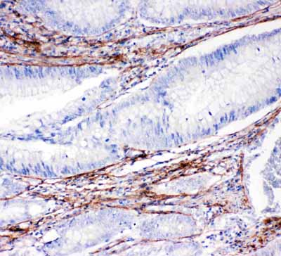 IHC - Anti-Collagen I Antibody ABO11450