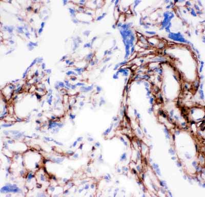 IHC - Anti-Collagen I Antibody ABO11450