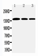 WB - Anti-Collagen I Antibody ABO11450