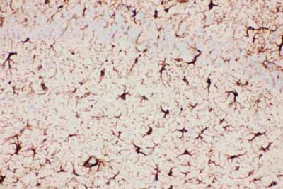 IHC - Anti-GFAP Picoband Antibody ABO11794