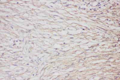 IHC - Anti-GFAP Picoband Antibody ABO11794