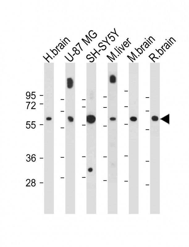 WB - INA (alpha internexin) Antibody (Center) AP6284c