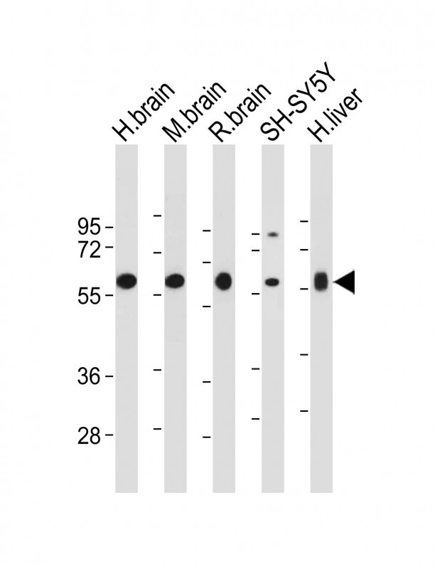 WB - INA (alpha internexin) Antibody (Center) AP6284c