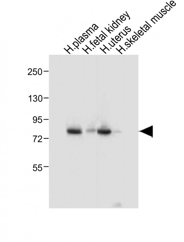 WB - LTF Antibody AP8698A