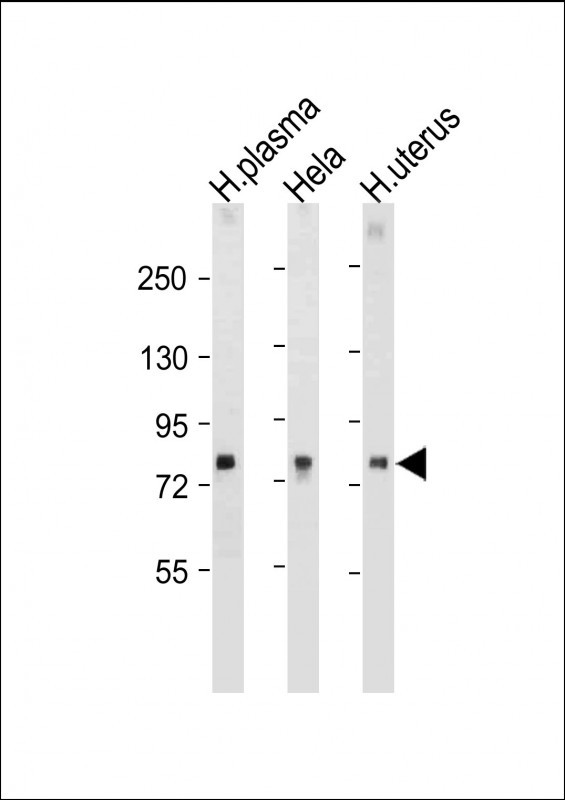 WB - LTF Antibody AP8698A