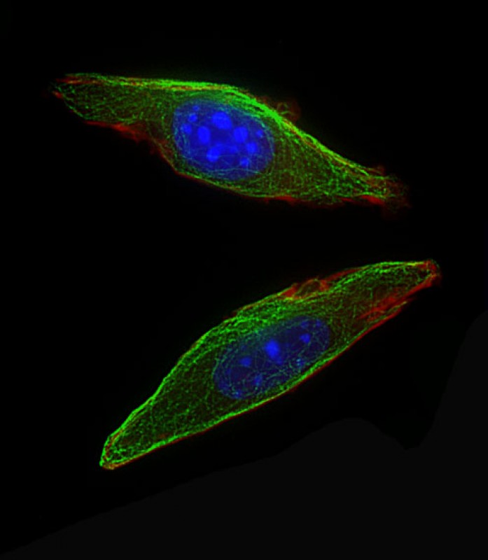 IF - Mouse Csf1r Antibody (C-term) AP13911b