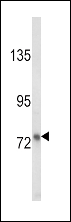 WB - LTF Antibody AP8698A