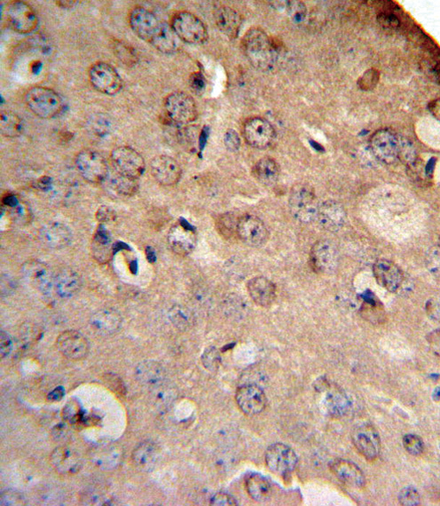 IHC-P - SLC8A1 Antibody (Center) AP8939C