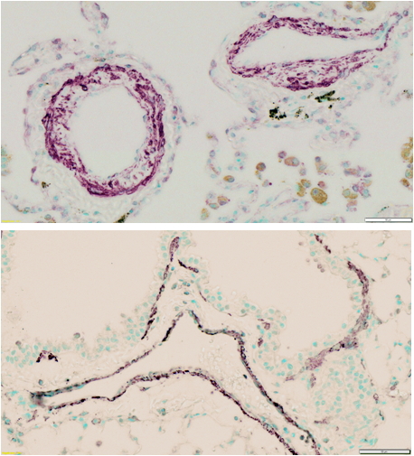 IHC - Goat Anti-Smooth muscle alpha-actin Antibody AF2010a