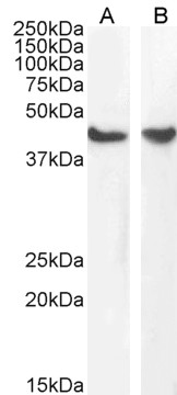 WB - Goat Anti-Smooth muscle alpha-actin Antibody AF2010a