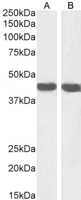  - Goat Anti-Smooth muscle alpha-actin Antibody AF2010a