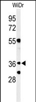 WB - NSE4A Antibody (N-term) AP9909a