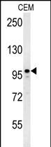 WB - MAP1S Antibody (Center) AP5769c