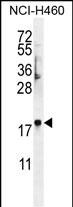 WB - FAM218A Antibody (C-term) AP11347b