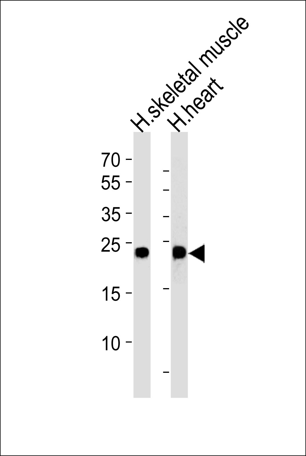 WB - MYL3 Antibody (N-term) AP14492a