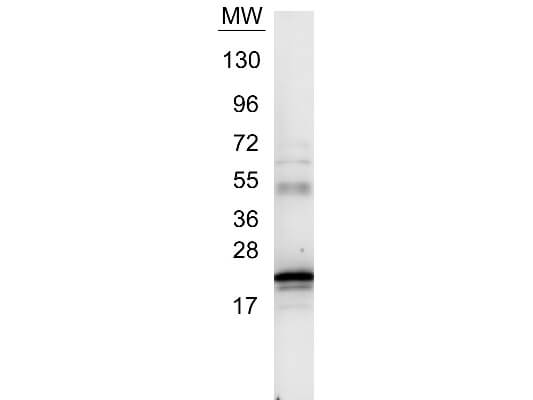  - Anti-Human IL-6 (RABBIT) Antibody ASR3863