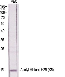 WB - Histone H2B (Acetyl Lys5) Polyclonal Antibody AP63200