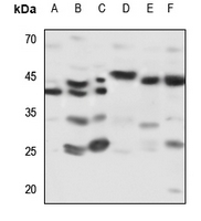 WB - Anti-Kappa-actin Antibody AP59907