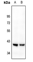 WB - Anti-Kappa Opioid Receptor Antibody AP61232