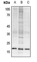 WB - Anti-Histone H3 (TriMethyl-K26) Antibody AP61426