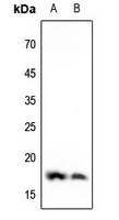 WB - Anti-Histone H3 (DiMethyl-K4) Antibody AP61430