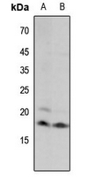 WB - Anti-Histone H3 (MonoMethyl-K18) Antibody AP61434