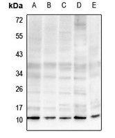 WB - Anti-Histone H4 (MonoMethyl-R19) Antibody AP61438