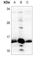 WB - Anti-Histone H2B (Butyryl-K12) Antibody AP61495