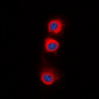 IF - Anti-PPP2CA Antibody AP61520