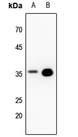 WB - Anti-PPP2CA Antibody AP61520