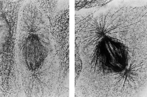 Light Micrograph of Nanogold vs. colloidal gold-Labeled Microtubules (81k)