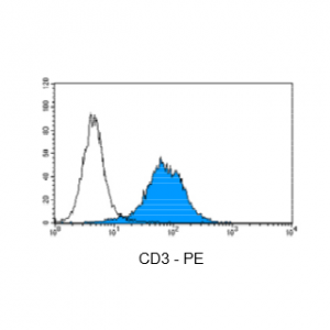 Figure 4: Immunostaining with Nordic-MUbio CD3-PE conjugate of surface CD3-negative undifferentiated leukemia cells of T-ALL type.