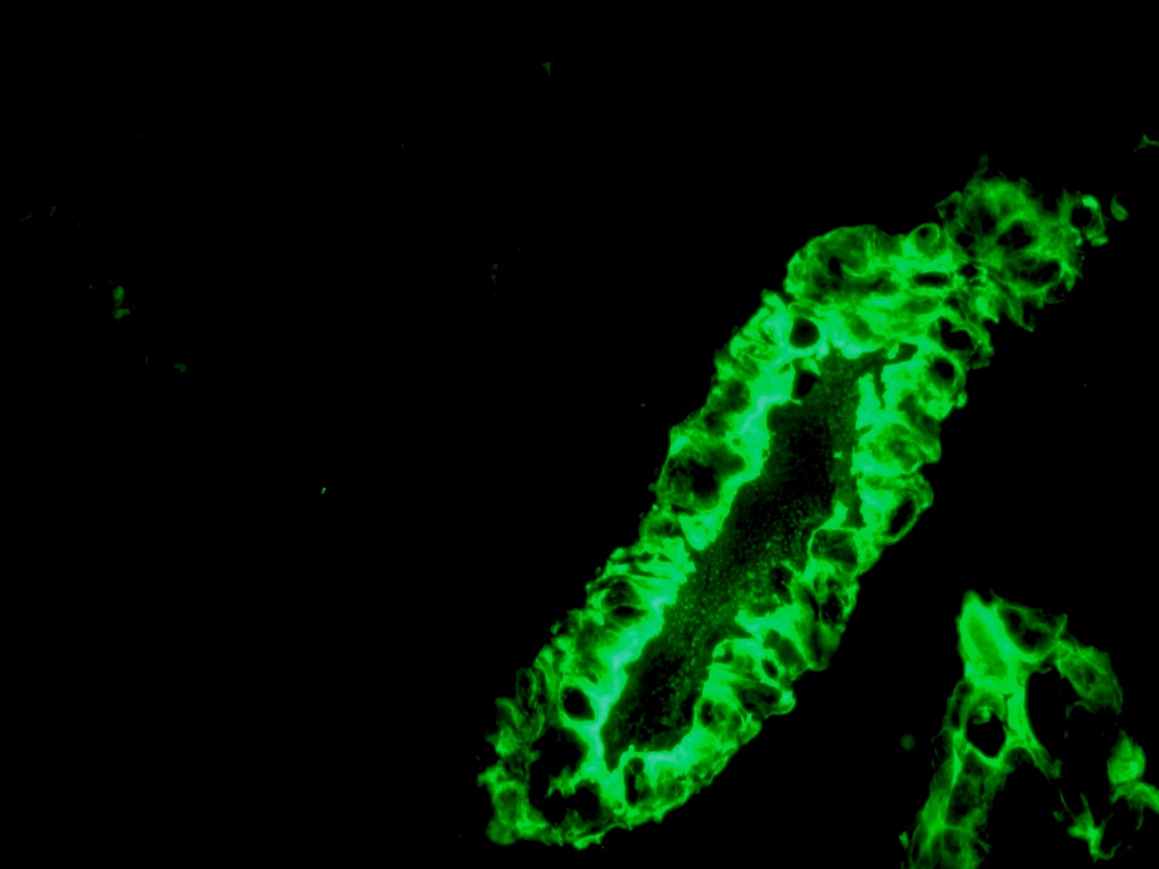 Figure 2 - Immunohistochemistry of MUB0315P (RCK105) on frozen sections of swine liver showing positive staining in the epithelial cells lining the bile ducts and no reactivity in hepatocytes or connective tissue. Dilution 1:500