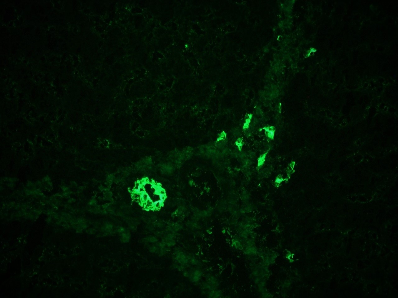 Figure 3 - Immunohistochemistry of MUB0315P (RCK105) on frozen sections of swine liver showing positive staining in the epithelial cells lining the bile ducts and no reactivity in hepatocytes or connective tissue. Dilution 1:500