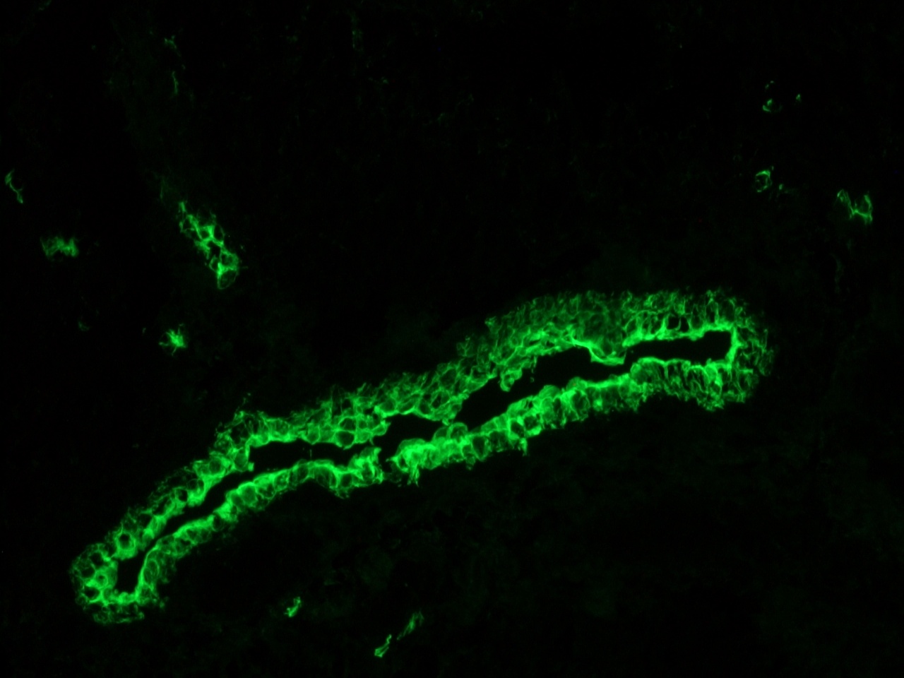 Figure 6. Immunohistochemistry of MUB0315P (RCK105) on frozen sections of swine liver showing positive staining in the epithelial cells lining the bile ducts and no reactivity in hepatocytes or connective tissue. Dilution 1:500