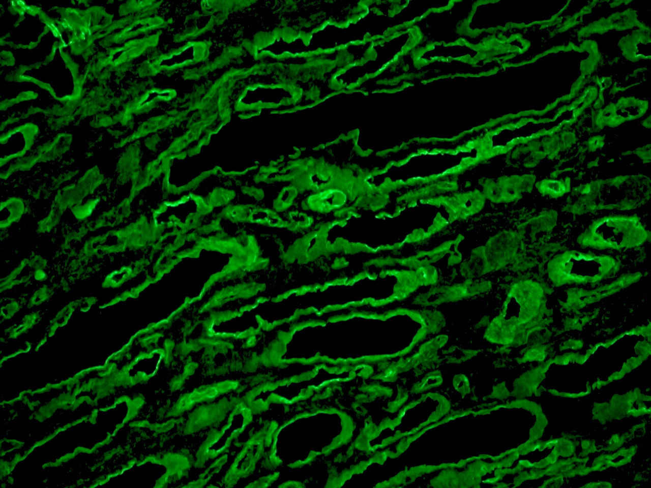 Figure 3 - Detection of laminin in human kidney frozen tissue section using monoclonal Rat anti Laminin MUB1100P, diluted 1:100