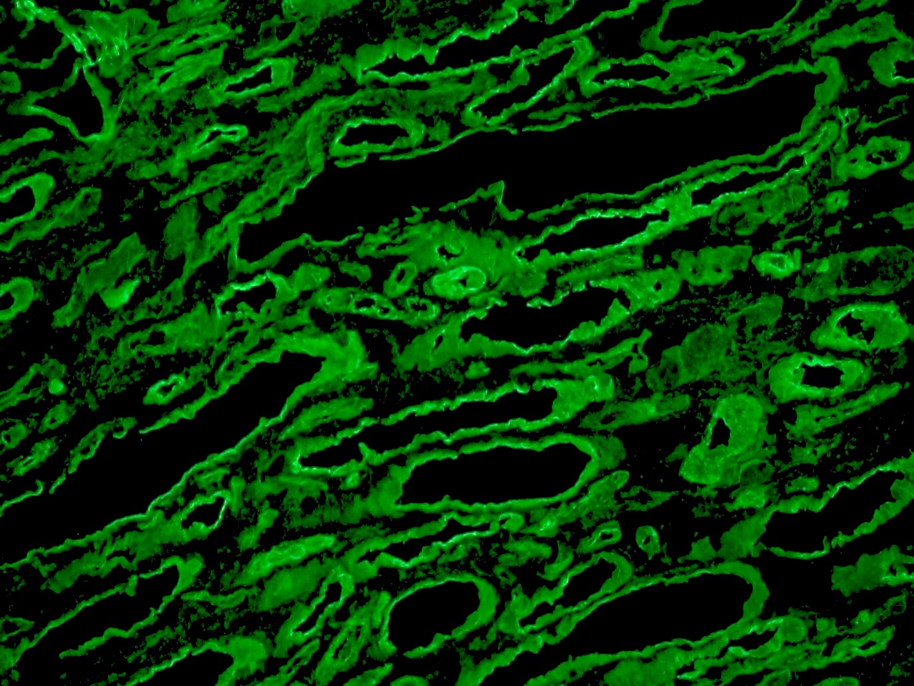 Figure 4 - Detection of laminin in human kidney frozen tissue section using monoclonal Rat anti Laminin MUB1100P, diluted 1:100