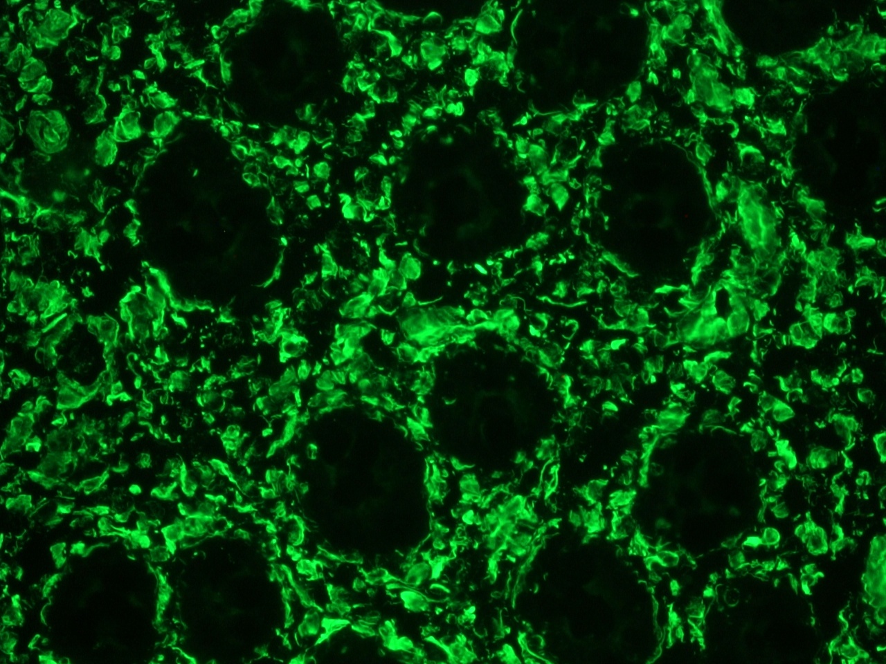 Figure 1. Immunohistochemistry on frozen section of swine colon showing positive staining in connective tissue cells and no reactivity in epithelial cells.