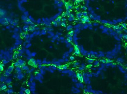 Figure 1. Immunohistochemistry with RV203 on a frozen section of human colon showing positive staining in connective tissue cells and no reactivity in epithelial cells.