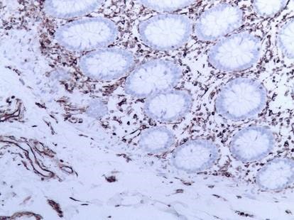 Figure 3. Immunostaining of human small intestine paraffin section with MUB1902P (clone V9). Note positive vimentin staining in connective tissue, but not in the epithelial cells.