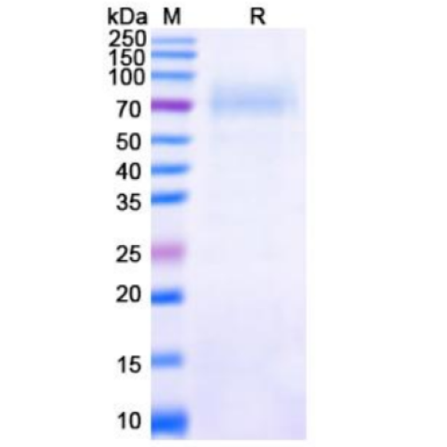 SDS-PAGE analysis of recombinant Nipah Virus glycoprotein G.