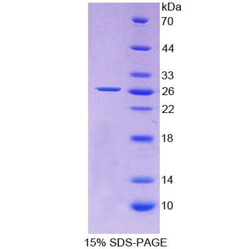 SDS-PAGE analysis of Rat Apolipoprotein A5 Protein.